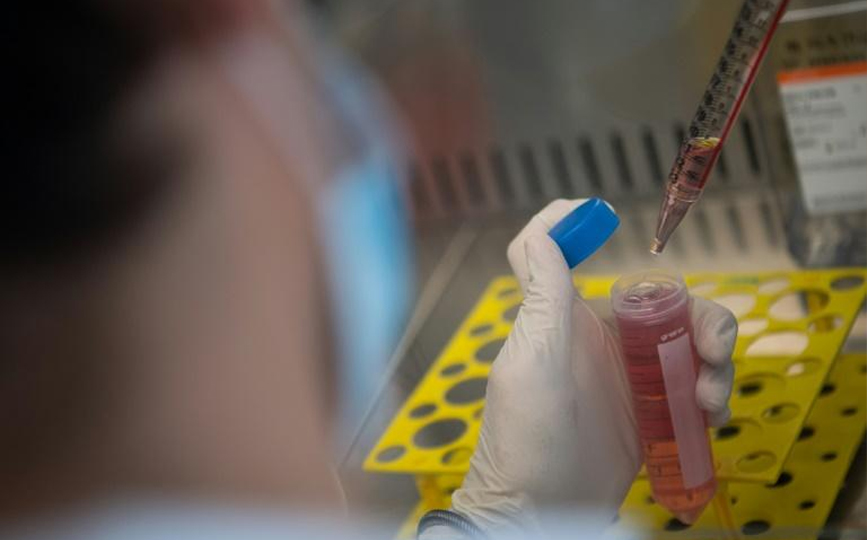 Des scientifiques sud-africains surveillent un nouveau variant du coronavirus possédant un taux de mutation inhabituel et dont la fréquence a graduellement augmenté ces derniers mois afp.com - LOIC VENANCE